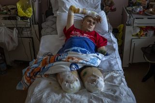 Hrůzná čísla z války: O končetinu přišlo 50 tisíc ukrajinských vojáků, hlavně kvůli minám